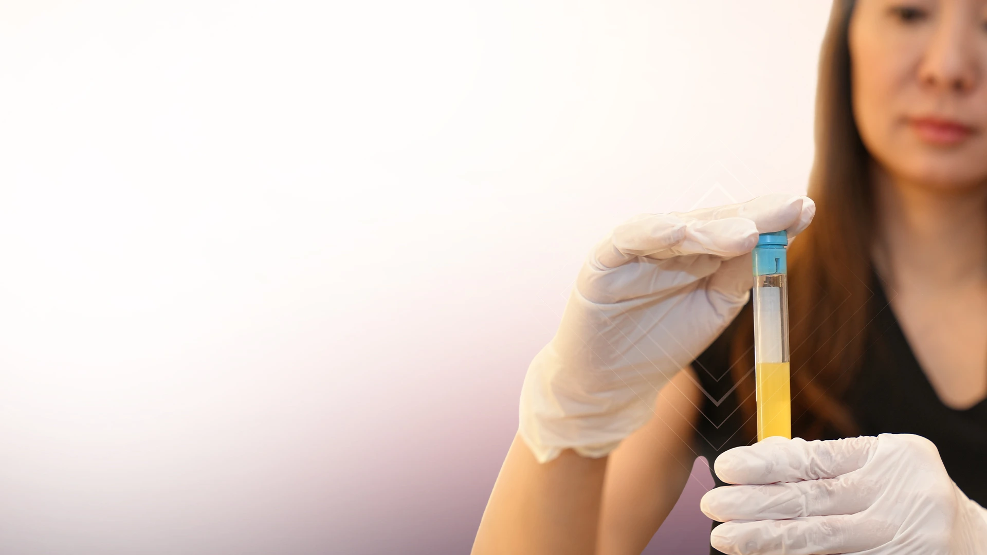 O-Shot (Orgasmic Shot) treatment at Toronto medical spa - PRP Injections to Support Intimate Wellness and Bladder Control...